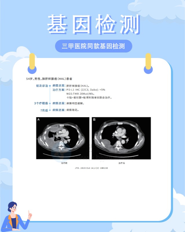縉云縣精準醫療：基因檢測指導藥物劑量